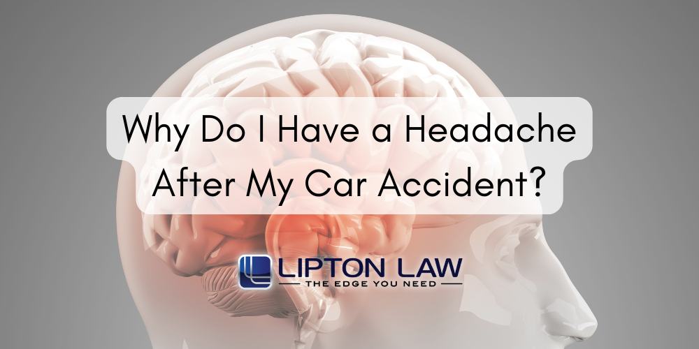 headache after car accident
