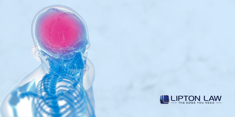 headache after car accident