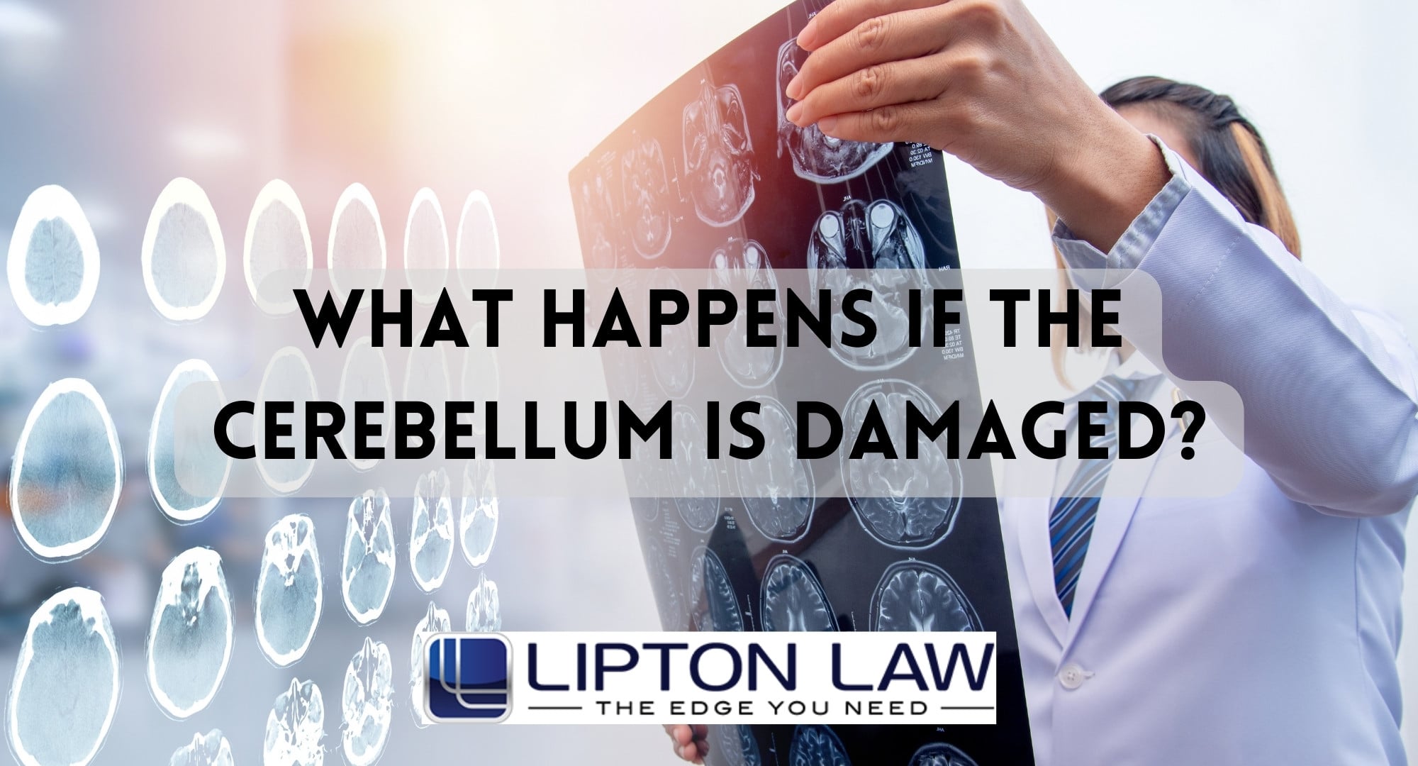 What Happens if the Cerebellum is Damaged