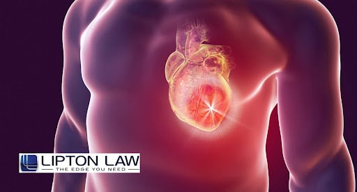 heart attack delayed diagnosis lawyer michigan