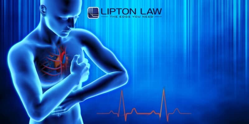 heart attack misdiagnosis lawyer