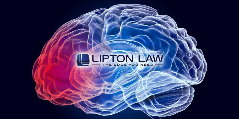 michigan brain injury lawyer