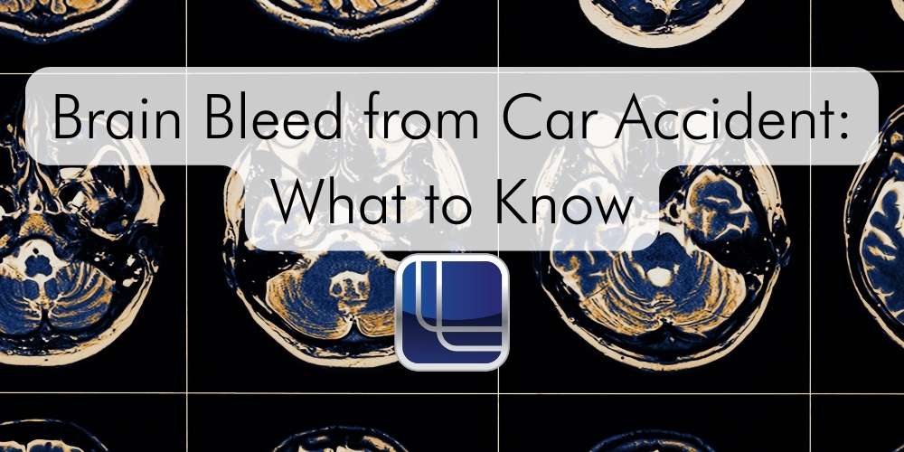 brain bleed from car accident
