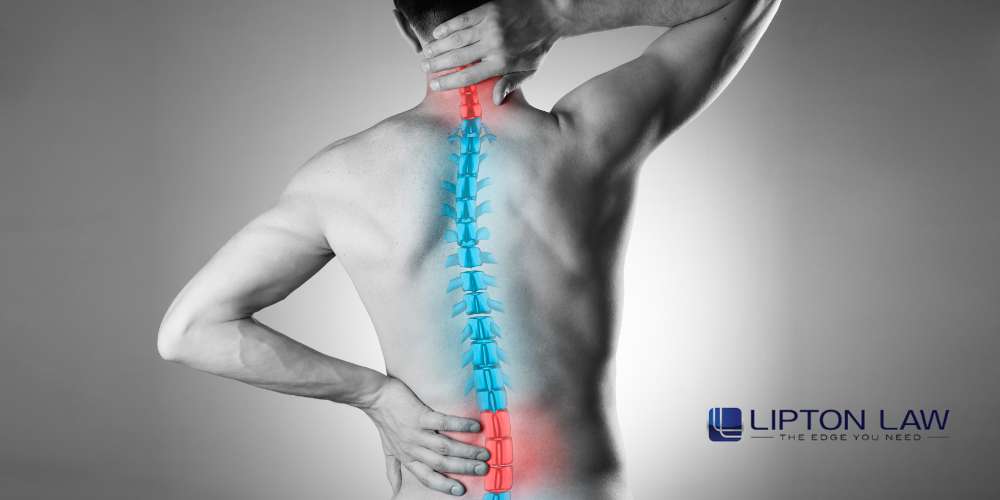 spinal cord injury lawyers MI