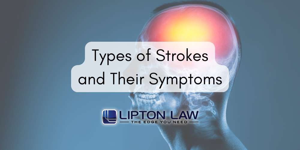 types of strokes and their symptoms