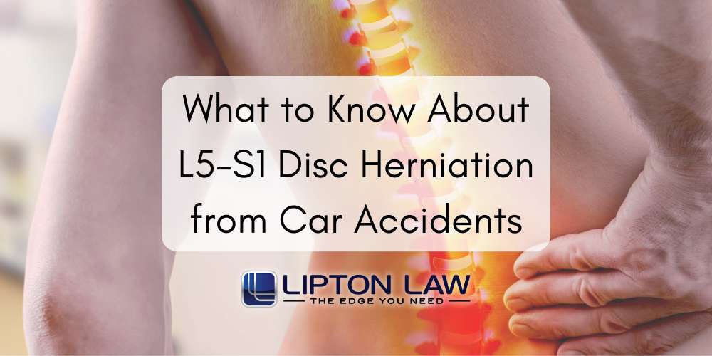 l5-s1 injury settlement