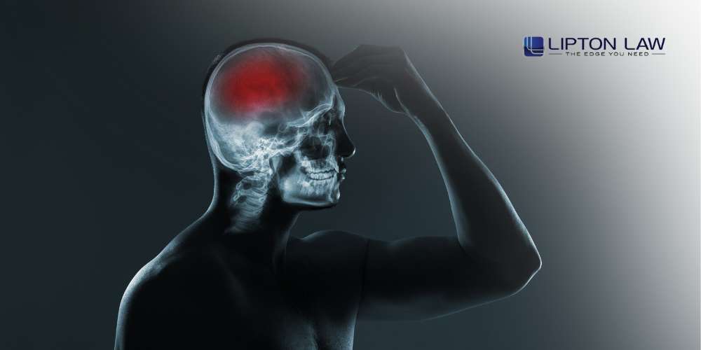 southfield mi tbi lawyer