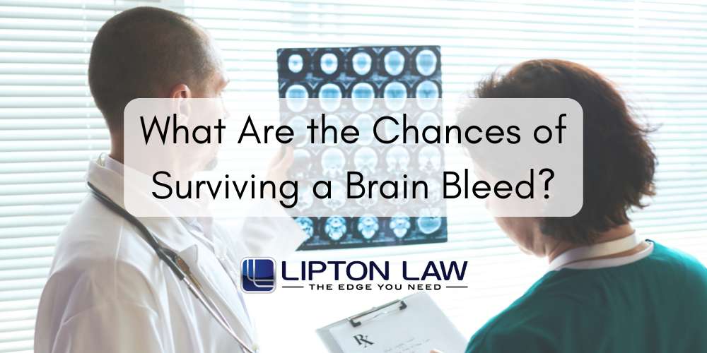 what are the chances of surviving a brain bleed
