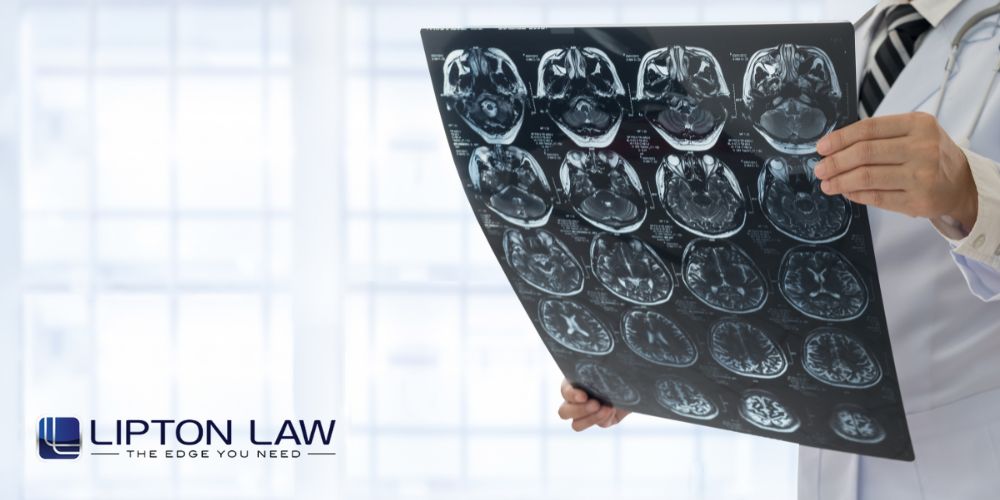 Michigan Elderly Choking Attorney