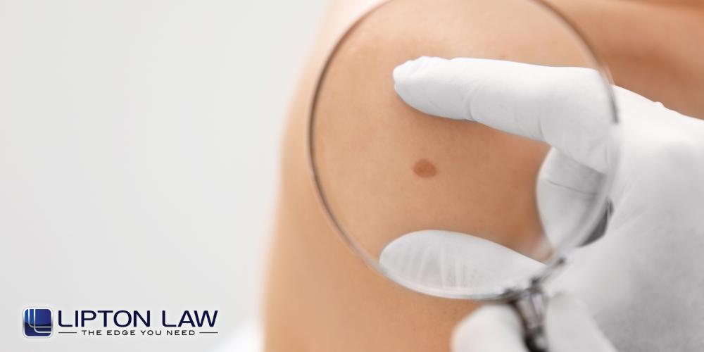 delayed cancer diagnosis