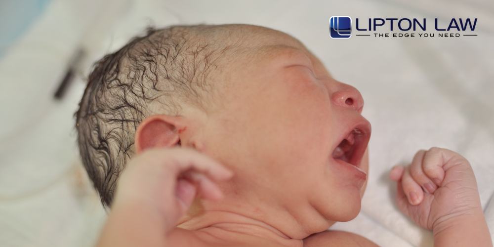 michigan brachial plexus injury lawyer